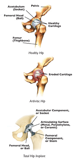 Common Arthritis Conditions