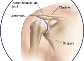 AC Joint Separation Photo