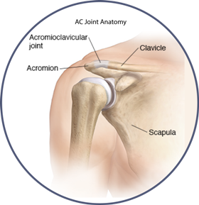 Separated Shoulder Separation | Local Shoulder Surgeon