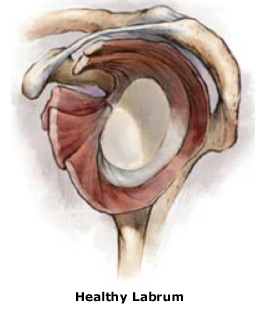 Healthy Shoulder Labrum