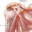 shoulder impingement